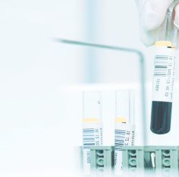 液相色譜化工應(yīng)用